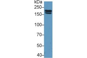 Detection of PZP in Rat Serum using Polyclonal Antibody to Pregnancy Zone Protein (PZP) (PZP 抗体  (AA 1251-1500))