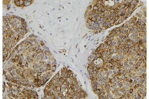ABIN6279063 at 1/100 staining Human pancreas tissue by IHC-P. (AWAT2 抗体  (Internal Region))