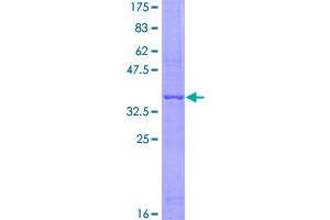 Image no. 1 for Adiponectin (ADIPOQ) (AA 111-210) protein (GST tag) (ABIN1306005)