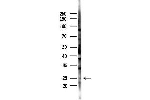 anti-LSM1 Homolog, U6 Small Nuclear RNA Associated (LSM1) (N-Term) antibody