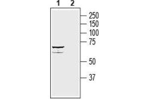 Western Blotting (WB) image for anti-Solute Carrier Family 39 (Zinc Transporter), Member 8 (SLC39A8) (AA 221-234), (Extracellular) antibody (ABIN7043726)