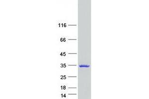TTC9 Protein (Myc-DYKDDDDK Tag)