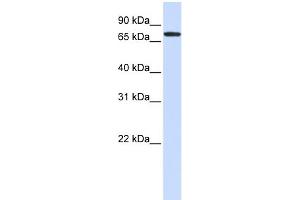 WB Suggested Anti-GALNT6 Antibody Titration:  0. (GALNT6 抗体  (Middle Region))