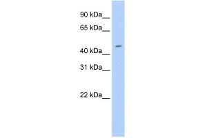 Western Blotting (WB) image for anti-E74-Like Factor 3 (Ets Domain Transcription Factor, Epithelial-Specific) (ELF3) (N-Term) antibody (ABIN2779832)