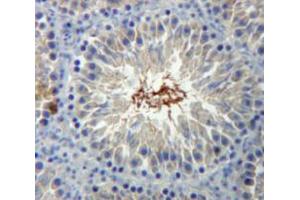 Used in DAB staining on fromalin fixed paraffin-embedded Testis tissue (BRCA2 抗体  (AA 2913-3151))