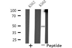 Western blot analysis of extracts from K562 cells using PP4R2 antibody. (PPP4R2 抗体  (Internal Region))