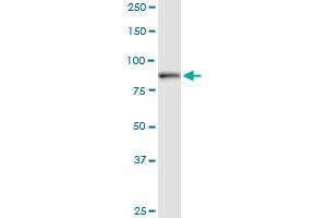 DCAMKL1 monoclonal antibody (M01), clone 7D10. (DCLK1 抗体  (AA 640-729))