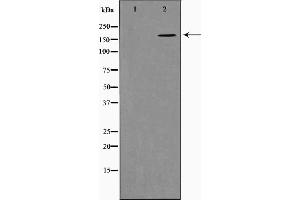 Western Blotting (WB) image for anti-Collagen, Type XI, alpha 1 (COL11A1) (Internal Region) antibody (ABIN6260952)
