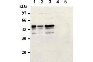 Western Blotting (WB) image for anti-Cyclin E1 (CCNE1) antibody (ABIN567783) (Cyclin E1 抗体)