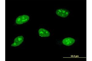 Immunofluorescence of monoclonal antibody to SOCS3 on HeLa cell. (SOCS3 抗体  (AA 1-225))