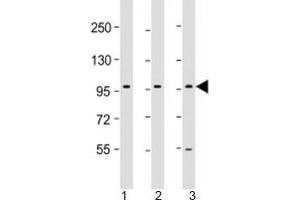 Western blot testing of human 1) HepG2, 2) PC-3 and 3) U-87 MG cell lysate with PCDH10 antibody at 1:2000. (PCDH10 抗体  (AA 128-160))