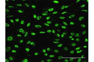 Immunofluorescence of monoclonal antibody to PLAG1 on HeLa cell. (PLAG1 抗体  (AA 2-99))