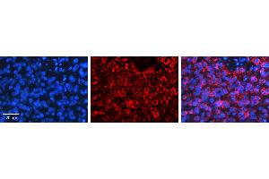 PSEN2 antibody - N-terminal region          Formalin Fixed Paraffin Embedded Tissue:  Human Pineal Tissue    Observed Staining:  Cytoplasm in Human Pineal Tissue   Primary Antibody Concentration:  1:100    Other Working Concentrations:  1/600    Secondary Antibody:  Donkey anti-Rabbit-Cy3    Secondary Antibody Concentration:  1:200    Magnification:  20X    Exposure Time:  0. (Presenilin 2 抗体  (N-Term))
