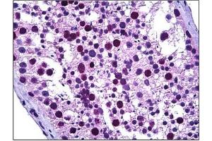 Human Testis: Formalin-Fixed, Paraffin-Embedded (FFPE) (TPX2 抗体  (Internal Region))