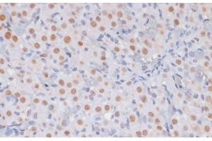 Immunohistochemistry of paraffin-embedded Rat ovary using TriMethyl-Histone H3-K27 Polyclonal Antibody at dilution of 1:100 (40x lens). (Histone 3 抗体  (3meLys27))