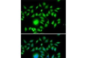 Immunofluorescence analysis of MCF7 cells using ATOH1 Polyclonal Antibody (ATOH1 抗体)