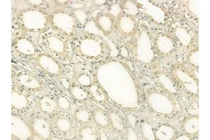 ABIN6265131 and ABIN6277621 at 1/100 staining human normal kidney tissue by IHC-P. (SLC3A1 抗体  (C-Term))