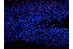 Immunostaining of granule cells in the dentate gyrus of saline treated mouse showing (MAPK1/2 (pThr202), (pTyr204) 抗体)