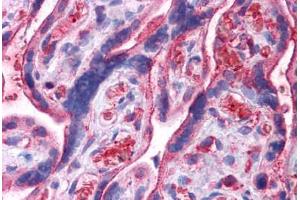 Human Placenta: Formalin-Fixed, Paraffin-Embedded (FFPE) (UCHL3 抗体  (N-Term))