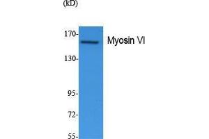Western Blotting (WB) image for anti-Myosin VI (MYO6) (N-Term) antibody (ABIN3187633) (Myosin VI 抗体  (N-Term))