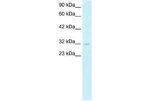 WB Suggested Anti-SIRT5 Antibody Titration:  1. (SIRT5 抗体  (Middle Region))