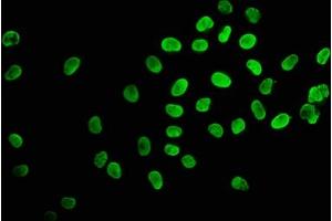 Immunofluorescence staining of Hela cells (treated with 30mM sodium butyrate for 4h) with ABIN7139155 at 1:2. (Histone H2B 抗体  (acLys120))