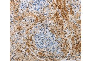 Immunohistochemistry of Human tonsil using NGFR Polyclonal Antibody at dilution of 1:50 (NGFR 抗体)