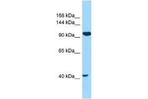 WB Suggested Anti-CILP2 Antibody Titration: 1.