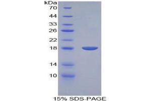 SDS-PAGE analysis of Rat BMP15 Protein. (BMP15 蛋白)