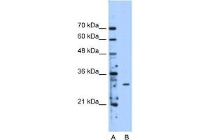 WB Suggested Anti-METTL1 Antibody Titration:  2. (METTL1 抗体  (Middle Region))