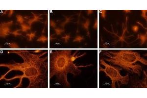 Expression of CNGA2 in rat cerebellum primary culture  - Immunocytochemical staining of paraformaldehyde-fixed and permeabilized rat cerebellum primary culture. (CNGA2 抗体  (Intracellular))