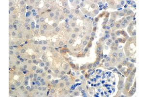 Immunohistochemistry analysis using Mouse Anti-ENaC beta Monoclonal Antibody, Clone 7B8 . (SCNN1B 抗体  (AA 617-638) (FITC))