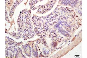 Immunohistochemistry (IHC) image for anti-Nuclear Receptor Subfamily 2, Group C, Member 2 (NR2C2) (pThr184), (pThr187) antibody (ABIN746348)