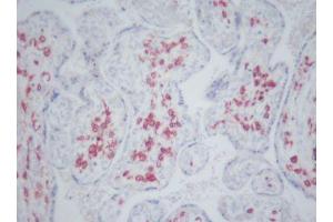 Image no. 3 for anti-CD163 (CD163) antibody (ABIN379967) (CD163 抗体)