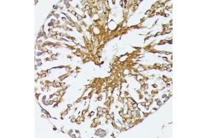 Immunohistochemistry (IHC) image for anti-Heat Shock 70kDa Protein 1A (HSPA1A) (AA 500-600) antibody (ABIN6142038)