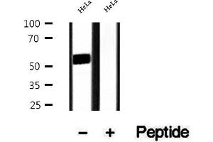 Western blot analysis of extracts of HeLa cells, using DMAP1 antibody. (DMAP1 抗体  (Internal Region))