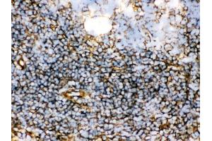 Anti- TGM2 Picoband antibody, IHC(F) IHC(F): Rat Spleen Tissue (Transglutaminase 2 抗体  (N-Term))