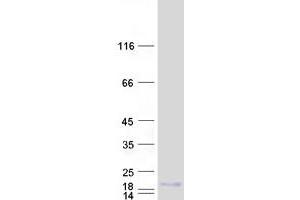 Western Blotting (WB) image for Small Proline Rich Protein 2A (SPRR2A) protein (Myc-DYKDDDDK Tag) (ABIN2732619)