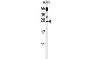 Western Blotting (WB) image for anti-Inosine Triphosphatase (ITPA) antibody (ABIN3002176) (ITPA 抗体)