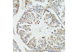 Immunohistochemistry of paraffin-embedded mouse testis using HSP70/HSP antibody (2948) at dilution of 1:100 (40x lens). (HSP70 1A 抗体  (AA 500-600))