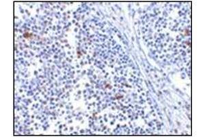 Immunohistochemistry of MDA5 in human lymph node tissue with MDA5 antibody at 5 μg/ml. (IFIH1 抗体  (Center))