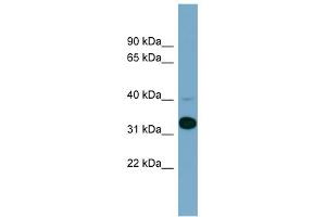 WB Suggested Anti-METAP1 Antibody Titration: 0. (METAP1 抗体  (N-Term))