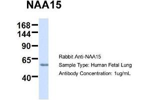 Host:  Rabbit  Target Name:  NAA15  Sample Type:  Human Fetal Lung  Antibody Dilution:  1. (NAA15 抗体  (N-Term))