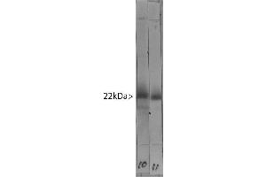 Western blot of bovine cerebellum homogenate stained with ABIN1580472 in lane 11. (VSNL1 抗体)