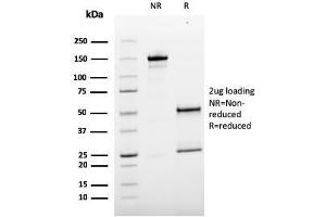 SDS-PAGE Analysis Purified MCAM Mouse Monoclonal Antibody (MCAM/3179). (MCAM 抗体)