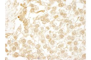 anti-WD Repeat Domain 20 (WDR20) (AA 450-500) antibody