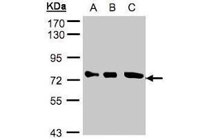 WB Image Sample(30 ug whole cell lysate) A:A431, B:H1299 C:Hep G2 , 10% SDS PAGE antibody diluted at 1:2000 (OPTN 抗体)