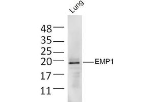 Mouse lung lysates probed with EMP1 Polyclonal Antibody, Unconjugated  at 1:300 dilution and 4˚C overnight incubation. (EMP1 抗体  (AA 101-160))