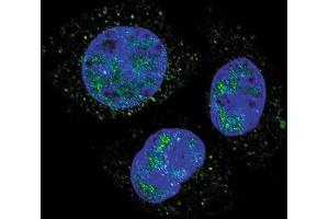 Confocal immunofluorescent analysis of Phospho-Rb- Antibody (ABIN389648 and ABIN2839638) with HepG2 cell followed by Alexa Fluor 488-conjugated goat anti-rabbit lgG (green). (Retinoblastoma 1 抗体  (pSer811))