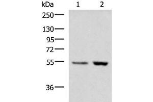 Western blot analysis of Human placenta tissue LOVO cell lysates using ZSWIM1 Polyclonal Antibody at dilution of 1:550 (ZSWIM1 抗体)